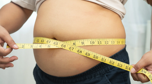 Gastric Sleeve Revision